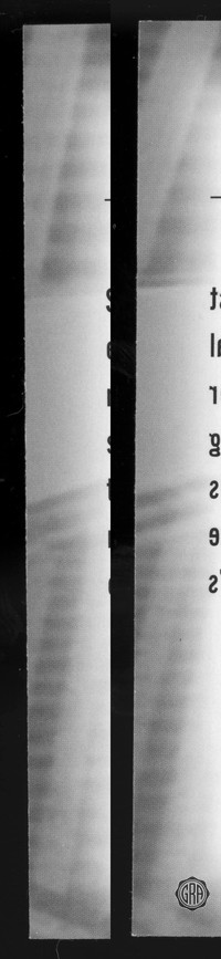 Back Edges (Left/Right)