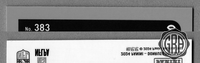 Back Edges (Top/Bottom)