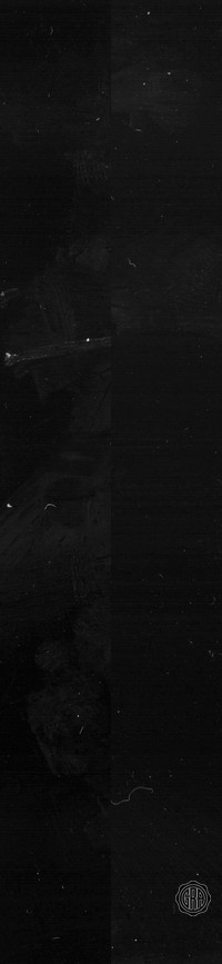 Back Edges (Left/Right)