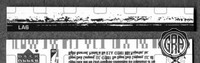 Back Edges (Top/Bottom)