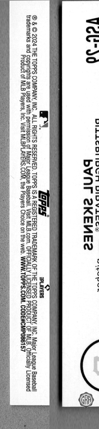 Back Edges (Left/Right)