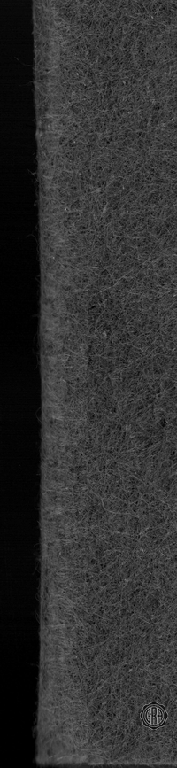 Back Edges (Left/Right)