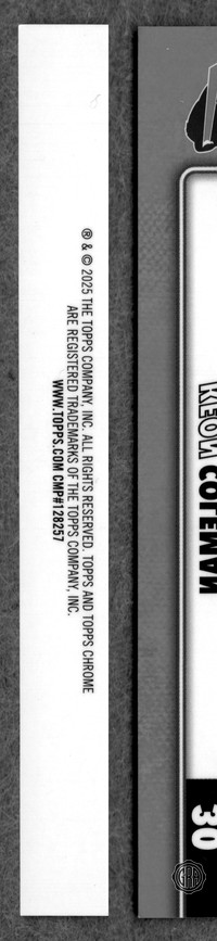Back Edges (Left/Right)