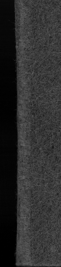 Back Edges (Left/Right)