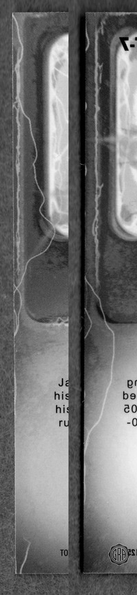 Back Edges (Left/Right)