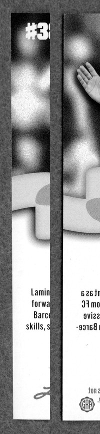 Back Edges (Left/Right)