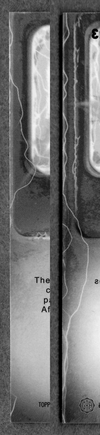 Back Edges (Left/Right)