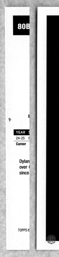 Back Edges (Left/Right)